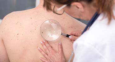 Servicio de Dermatología Clínica María de Molina